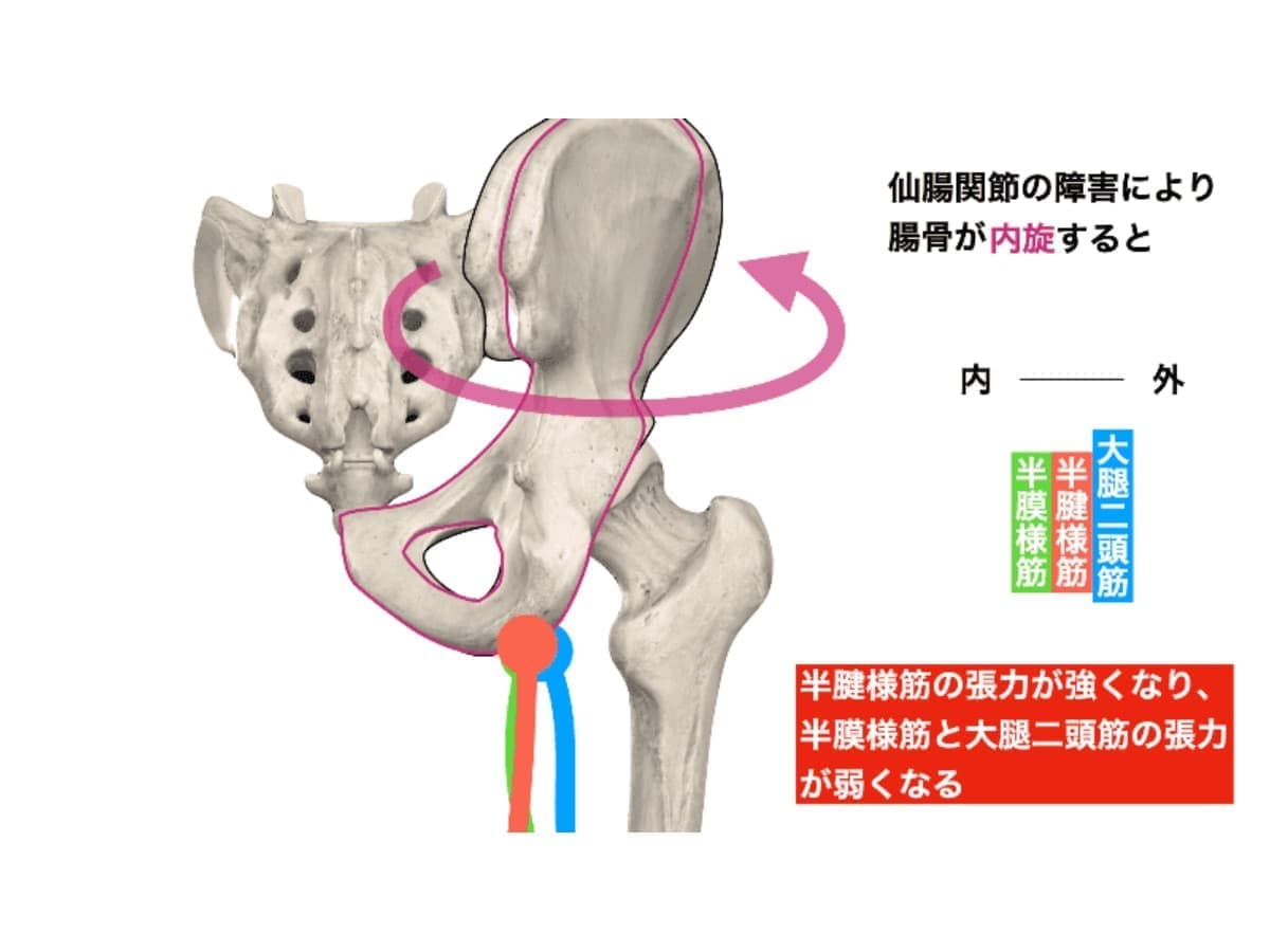 仙腸関節とハムストリングス の緊張について