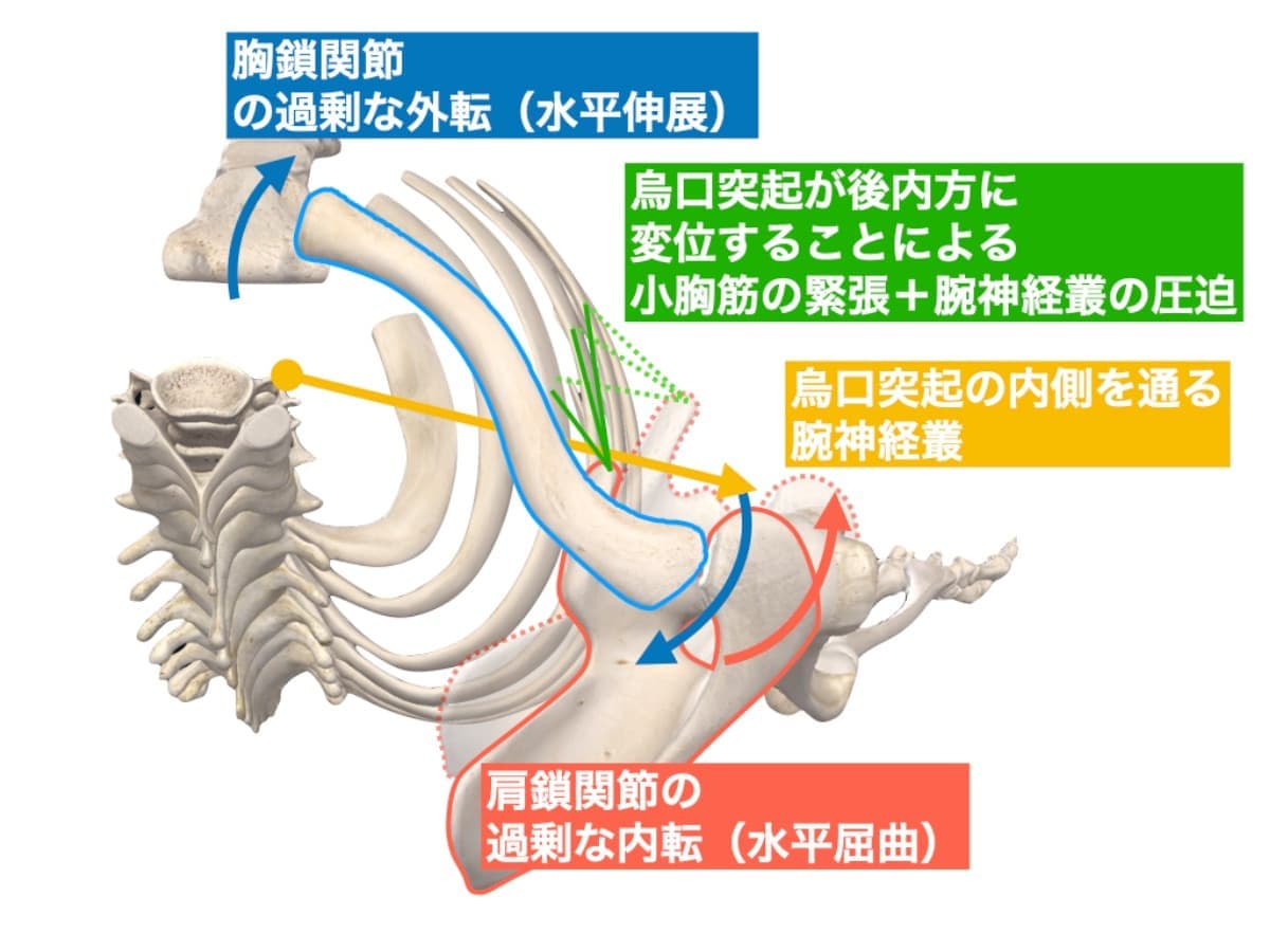 仙腸関節と坐骨神経の関連